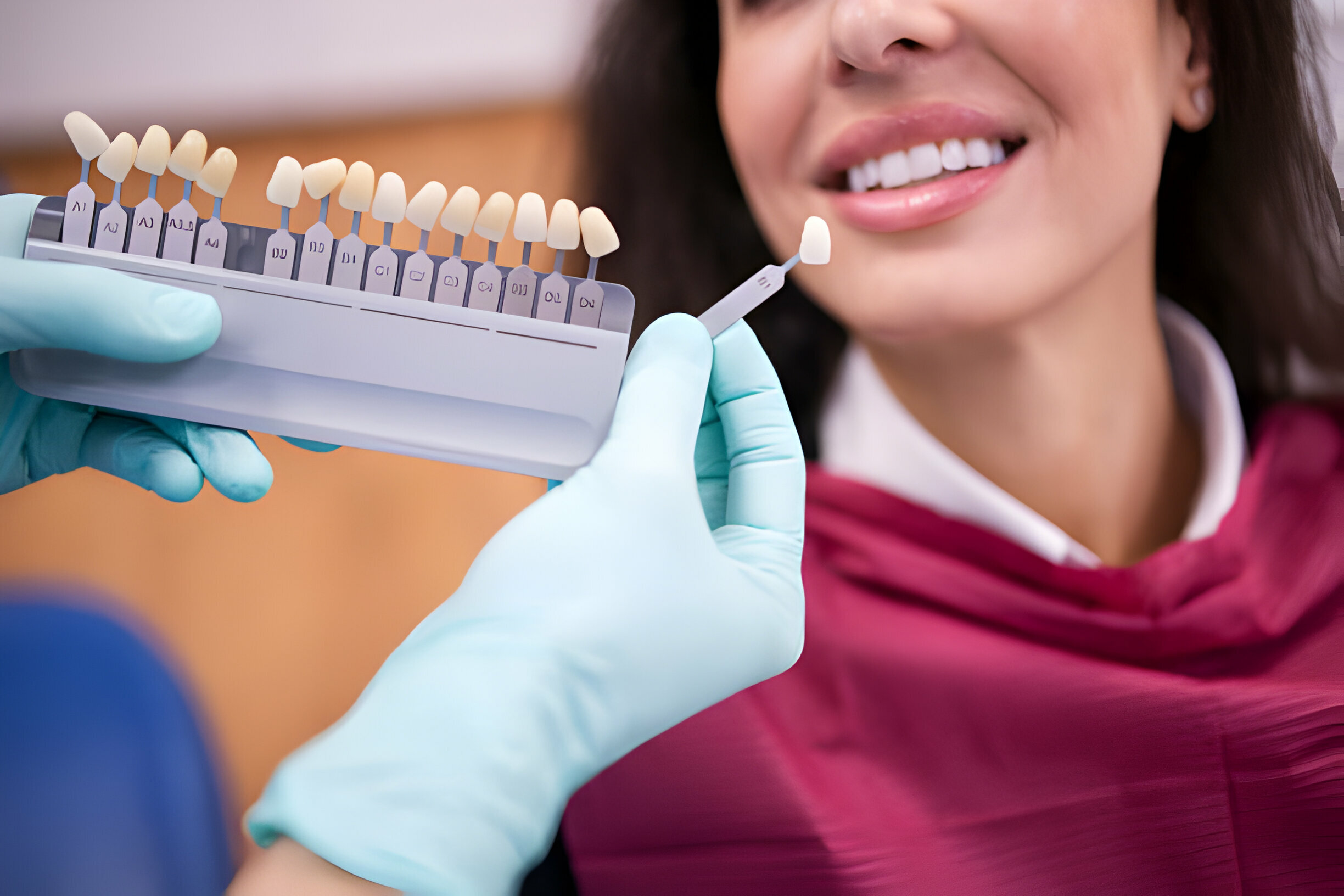 Why Porcelain Veneers Are the Go-To Choice for Smile Makeovers?_1