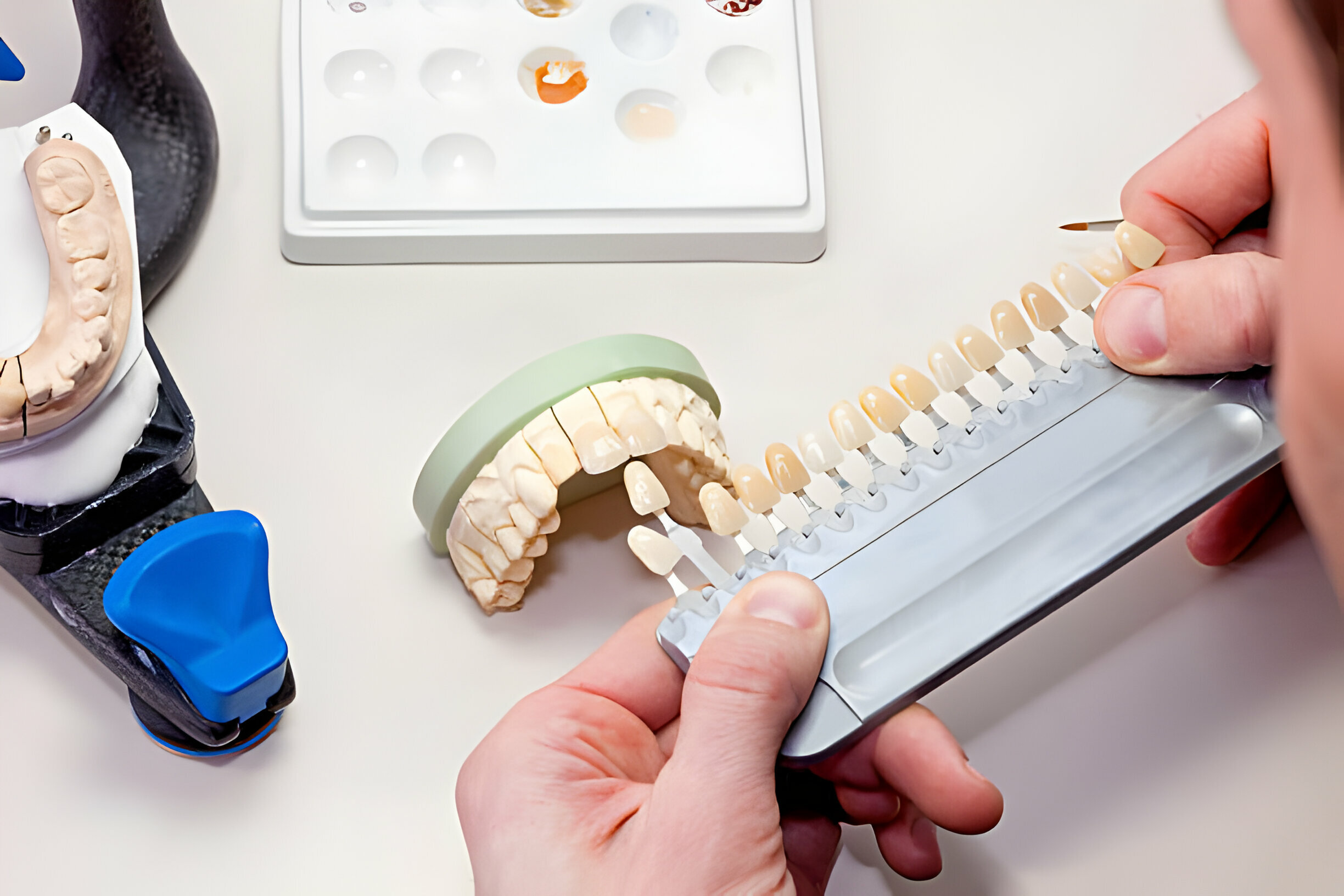 Why Porcelain Veneers Are the Go-To Choice for Smile Makeovers?_3