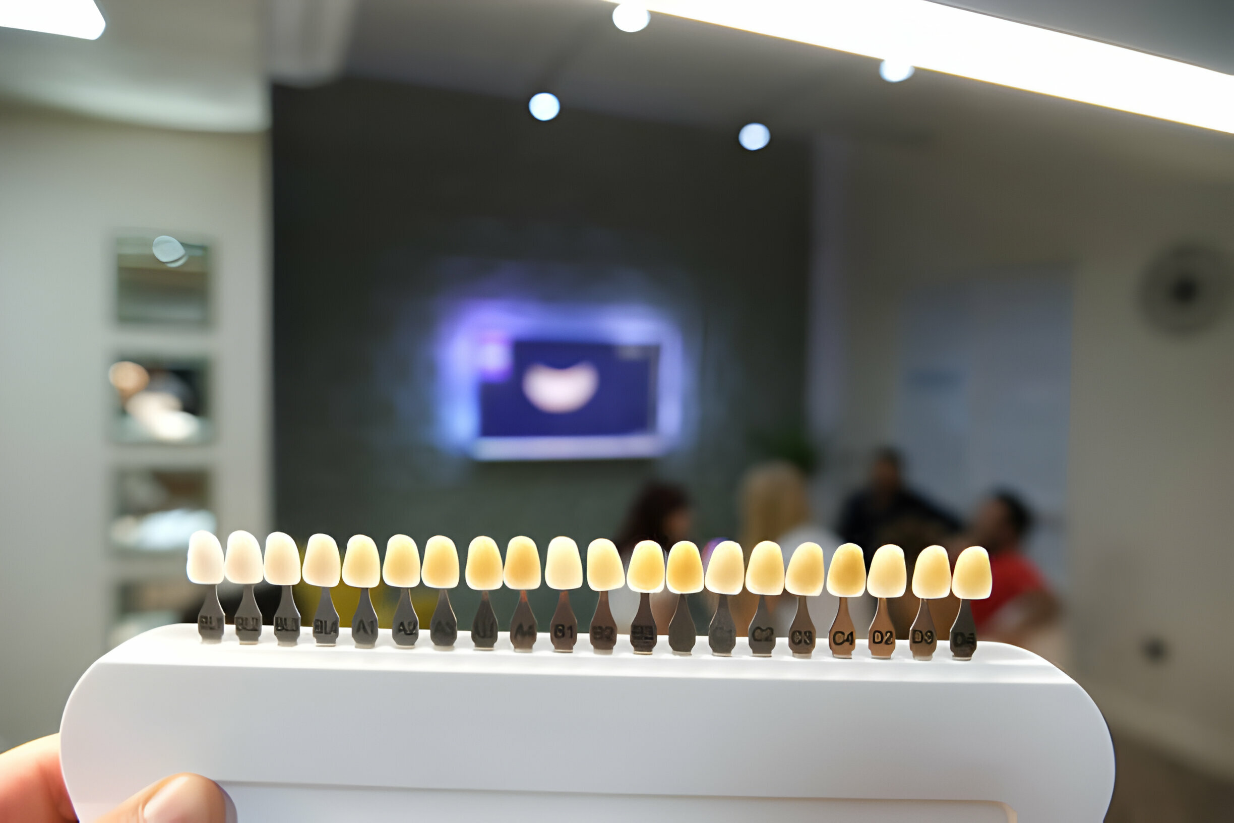 Why Porcelain Veneers Are the Go-To Choice for Smile Makeovers?_FI