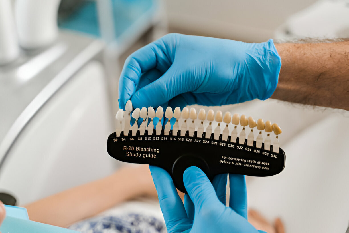 Transform Your Smile with Porcelain Veneers at Caring Modern Dentistry in Reidsville, NC_FI