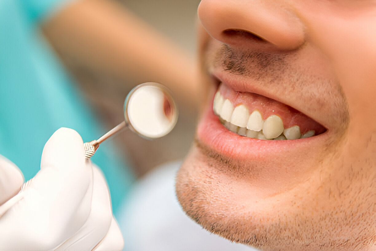 The Essential Guide to Dental Cleanings and Exams from Caring Modern Dentistry in Reidsville, North Carolina_FI